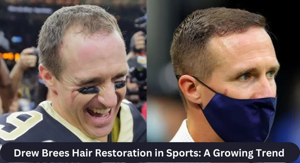 this image shown in Drew Brees Hair Restoration in Sports: A Growing Trend